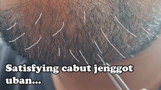 Satisfying cabut jenggot uban