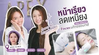 Focus Ultrasound ยกกระชับ สลายเหนียง หน้าเรียว