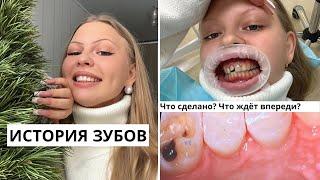 ИСТОРИЯ ЗУБОВ / и это не конец!