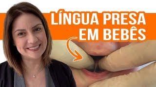 Língua Presa em Bebês e como ela Interfere na Amamentação - ANDRESSA BORTOLASSO