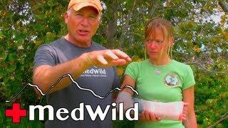 How to use a SAM Splint (Forearm) | Wilderness Medicine