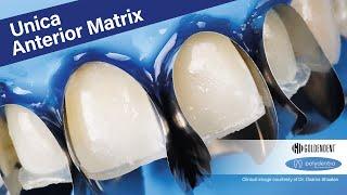 Polydentia Unica Anterior Matrix System GoldenDent - How Does Unica Anterior System Work?