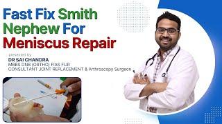 Fast Fix.. Smith n Nephew..For Meniscus Repair...Dr Sai Chandra