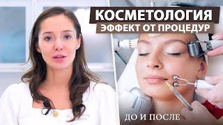 Почему эффект от косметологических процедур быстро проходит?