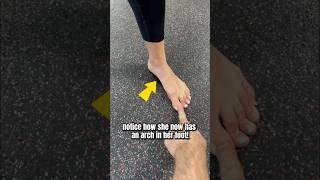 How To Fix Flat Feet Naturally!