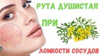 Рута трава душистая при ломкости сосудов: применение и приготовление.