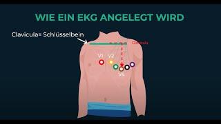 EKG anbringen einfach erklärt | Novaheal