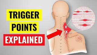 What Science ACTUALLY Says About Trigger Points & Myofascial Pain