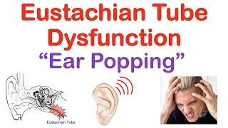 Eustachian Tube Dysfunction (“Popping Sound in Ears”) | Causes, Symptoms, Diagnosis, Treatment
