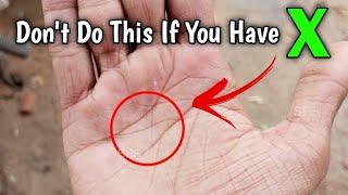 Don't Do This If You X Sign On Your Palm | Cross sign in palmistry