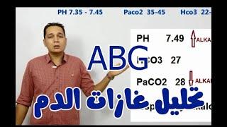 ازاى تقرا غازات الدم HOT TO INTERPRET ABG