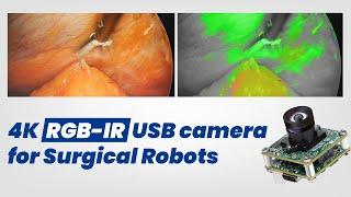 8MP RGB-IR USB camera for Surgical Robots | Simultaneous RGB & IR Streaming | e-con Systems