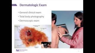 Melanoma: Introduction to Evolution, Diagnosis, & Treatment