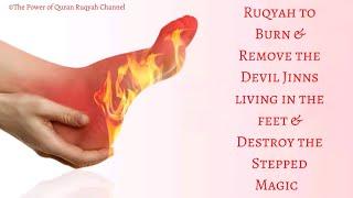 Ultimate Ruqyah to burn & remove Devil Jinns living in the legs & feet & Destroy the Stepped Magic