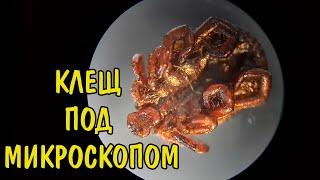 ИКСОДОВЫЙ КЛЕЩ ПОД МИКРОСКОПОМ