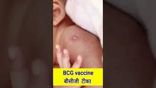 BCG vaccine for newborns |#shorts  | बीसीजी टीका |vaccine |