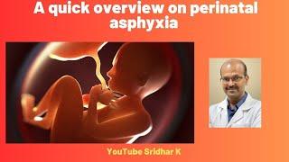 Perinatal asphyxia. A quick overview. #asphyxia #perinatalasphyxia #birthasphyxia