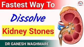 4 Best Medicines For Kidney Stones | Kidney Stone Treatment | How To Prevent Kidney Stones