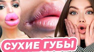 ЧТО СКРЫВАЮТ СУХИЕ ГУБЫ?