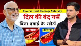 Reverse Heart Blockage Naturally Ft. Dr. Susheel Sharma | Unclog Arteries | Himanshu Bhatt