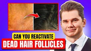 Is Hair Regrowth Still Possible In Late 30s By Treatment?