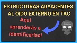 Oído externo 2 : RELACIONES ANATÓMICAS del CONDUCTO AUDITIVO EXTERNO en TAC