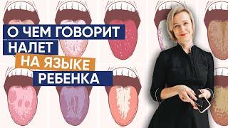 О чем говорит налет на языке ребенка