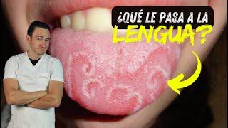 Esto le pasa a tu lengua si pierdes una o más muelas 