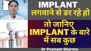 Kya Dental Implant Safe Hai||Dental Implant Ke Nuksan||क्या दांतो में Implant लगवाना सही है #implant