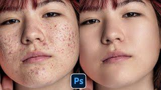 Face Retouching - Best Photoshop Tutorial | Skin Retouching 2023