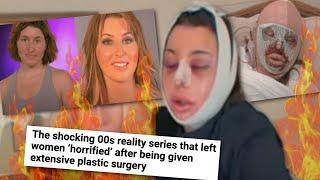 Plastic Surgery Makeover Show GONE WRONG: The BOTCHED Surgeries Behind The Swan