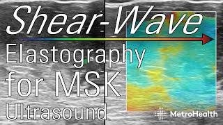 Shear-Wave Elastography for MSK Ultrasound w/ Sean Gibson