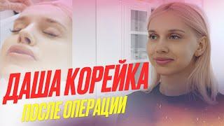 ДАША КОРЕЙКА | ПОСЛЕ ОПЕРАЦИИ | УВЕЛИЧЕНИЕ ГУБ!