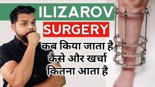 Ilizarov Surgery क्या है कैसे किया जाता है | Ilizarov Technique In Hindi  Orthopaedic Surgery