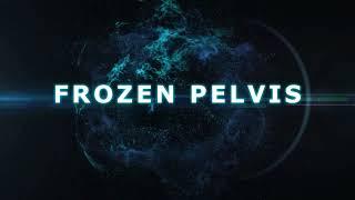 TIPS & TRICKS OF DEFREEZING THE FROZEN PELVIS(UNEDITED)/# LAPAROSCOPIC /  PELVIC ENDOMETRIOSIS/#TLH