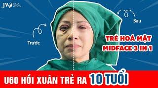 TRĂM NGHE KHÔNG BẰNG MỘT THẤY: Bà ngoại U60 HỒI XUÂN 10 TUỔI nhờ trẻ hoá khuôn mặt MIDFACE 3 IN 1