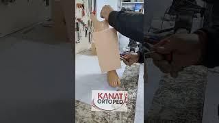 DİZALTI PROTEZ-AMPUTEE MODEL-AKTİF VAKUM SİSTEMLİ PROTEZ-KOZMETİK KAPLAMA-PROSTHETİC LEG COVER