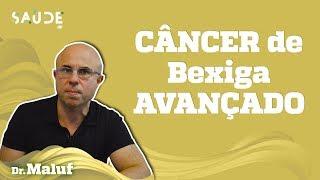 CÂNCER de BEXIGA AVANÇADO: uma DOENÇA potencialmente GRAVE | Dr. Maluf