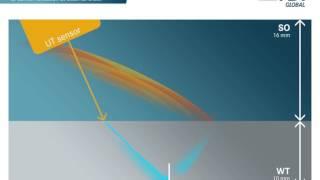 NDT Global - Ultrasonic Crack Inspection