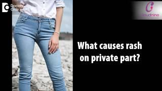 What causes rash on private part? -Dr. Vibha Arora of Cloudnine Hospitals | Doctors' Circle