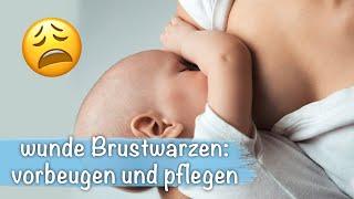 Stillen: Brustwarzen schmerzen?