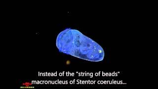 Stentor with a vermiform macronucleus