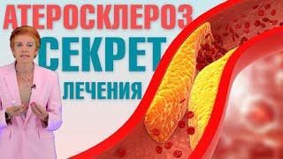 Как помочь себе при атеросклерозе? Атеросклероз - что это такое и как его  лечить