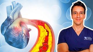 Atherosclerosis | Cholesterol, LDL, HDL, Triglycerides