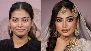 Pimple Skin Makeup | Oily Skin Makeup Tutorial | Long Lasting Makeup | @pkmakeupstudio