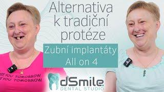 All-on-4: Náhrada zubů ve 45 letech – Konec s protézou!#implant#dentist #dsmile#allon4dentalimplants