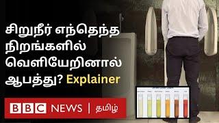 உங்க Urine Colour சொல்லும் ரகசியம் என்ன? இது தெரிஞ்சா Health Issues-ஐ முன் கூட்டியே அறியலாம்