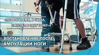 Ампутация ноги | Восстановление навыков ходьбы с протезом