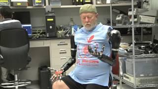 Amputee Makes History with APL’s Modular Prosthetic Limb