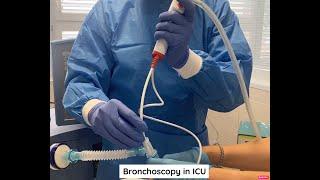 Bronchoscopy in ICU